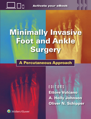 Minimally Invasive Surgery in Foot and Ankle