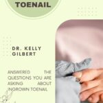 ingrown toenail