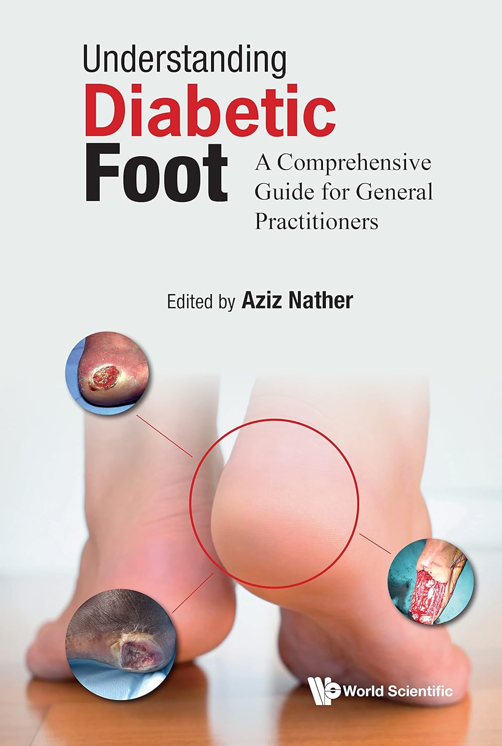 understanding-diabetic-foot-a-comprehensive-guide-for-general