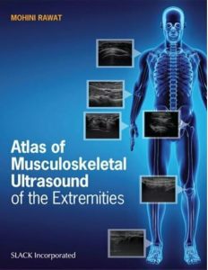 Atlas of Musculoskeletal Ultrasound of the Extremities