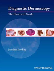 Diagnostic Dermoscopy: The Illustrated Guide